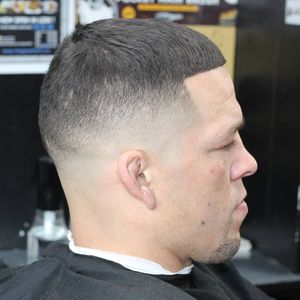 Nate Diaz with a fresh cut courtesy JP.